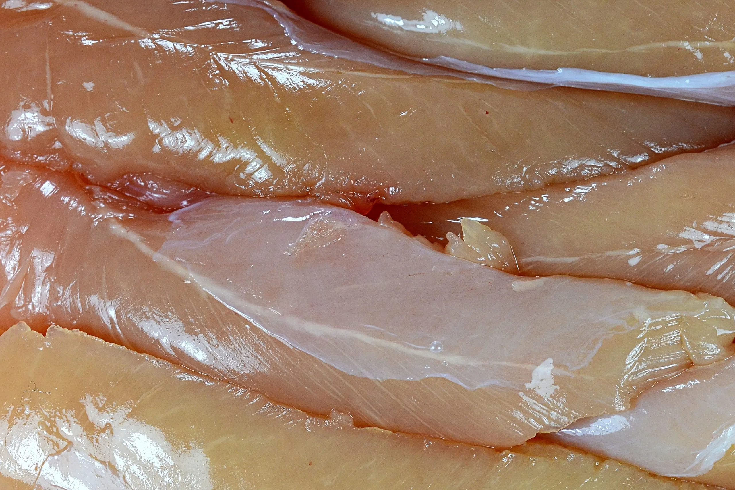 Lebensmittelbedingte Erkrankungen