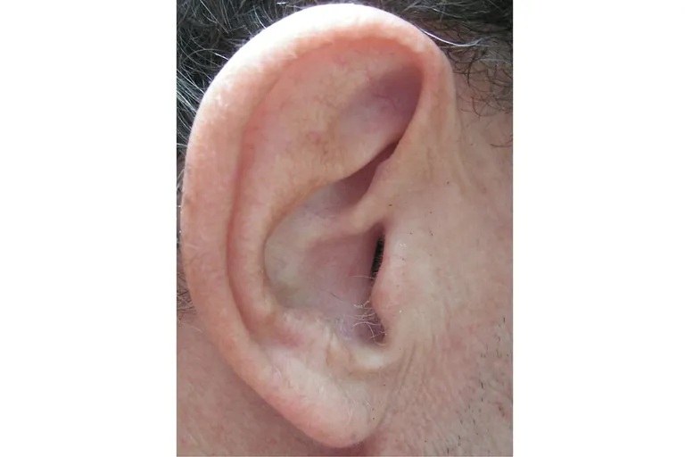 Den Kunden zuh&ouml;ren