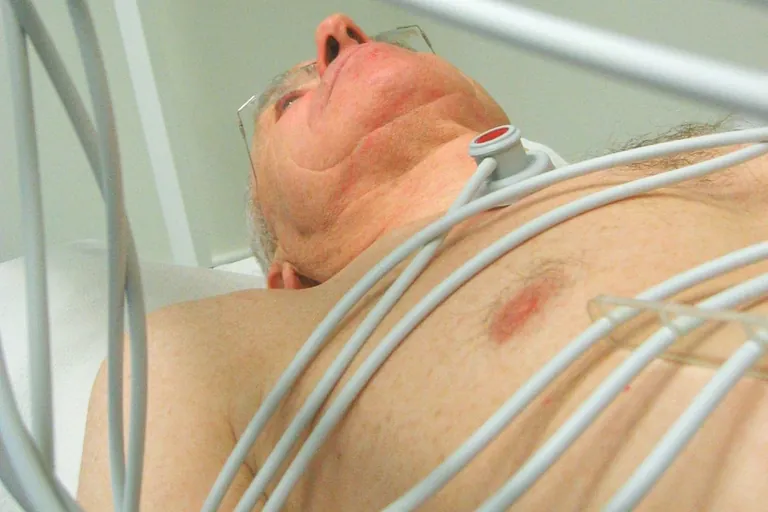 Anerkennung einer Berufskrankheit