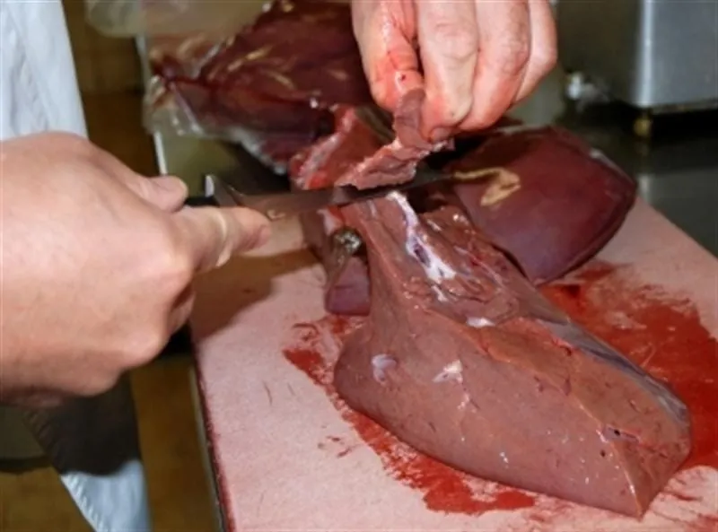 Leber-Fett-Verhältnis beachten